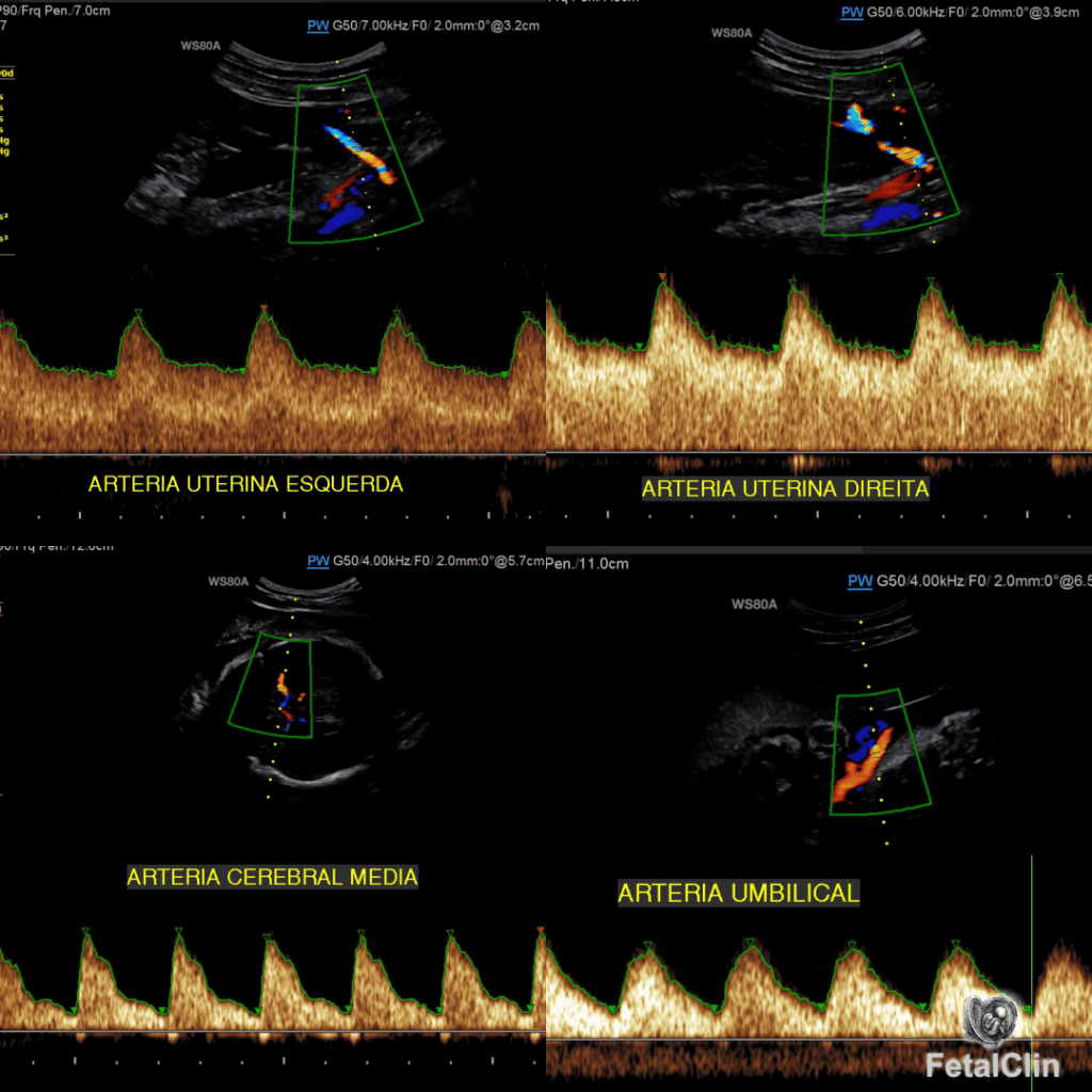 Exames Fetalclin Medicina Fetal Em União Da Vitória 9800