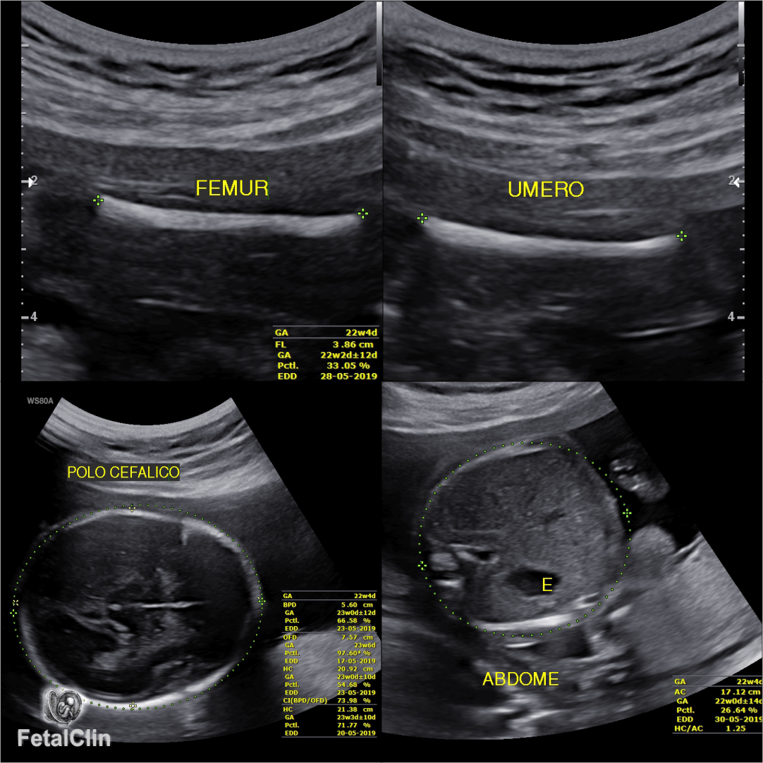 Obstetrica